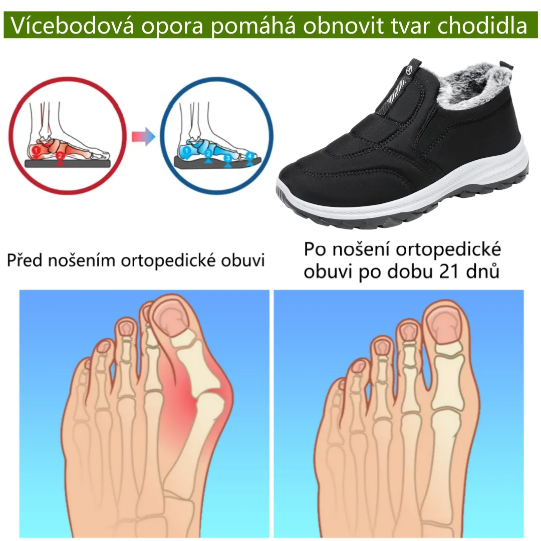 ⚡Omezený slevy 50% —— Ergonomická ortopedická obuv s chloupkatou podšívkou, ulevuje od bolestí nohou, zad a kloubů, unisex