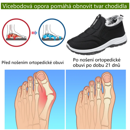 ⚡Omezený slevy 50% —— Ergonomická ortopedická obuv s chloupkatou podšívkou, ulevuje od bolestí nohou, zad a kloubů, unisex