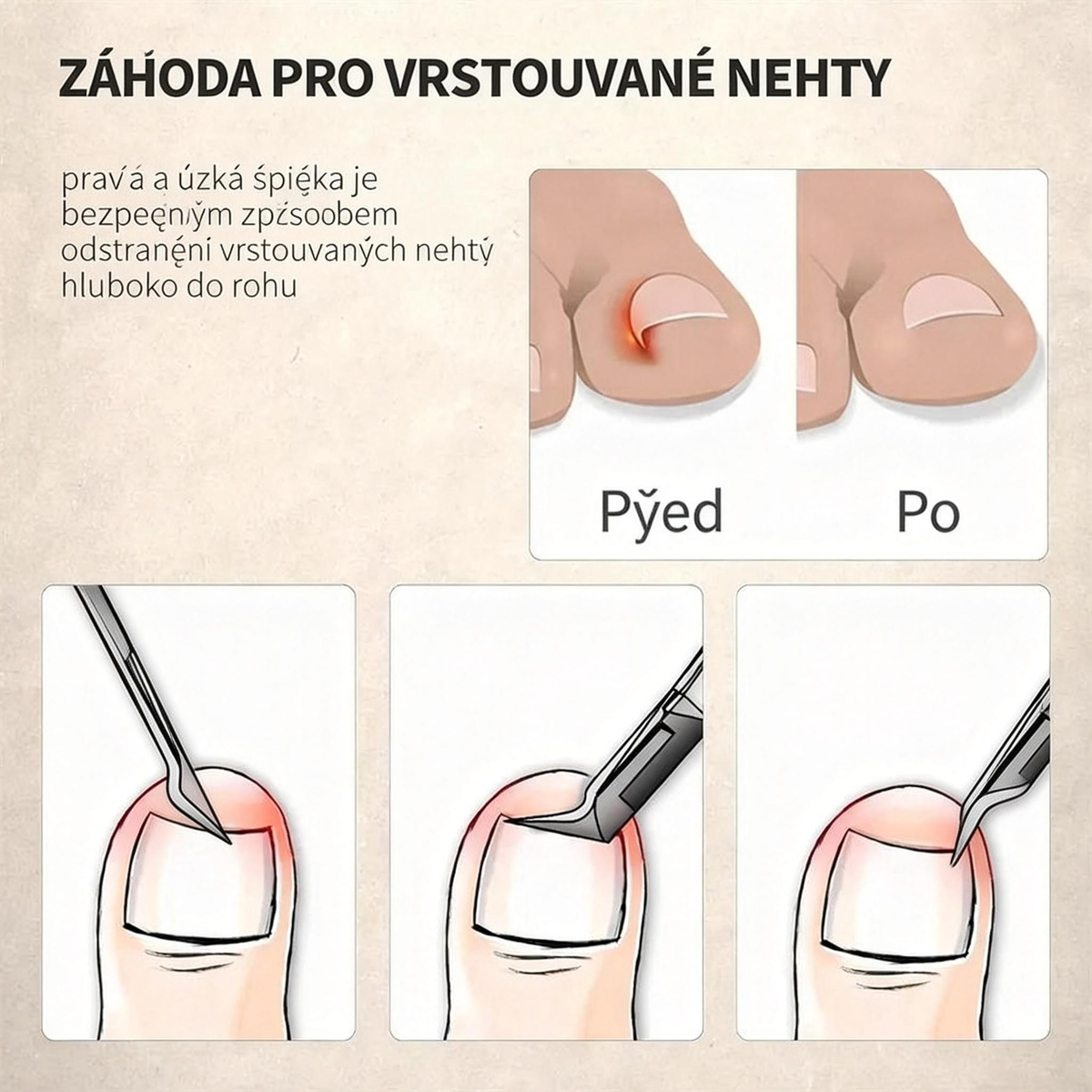 🎉 Exkluzivně pro členy –Speciálně navrženy pro seniory, nůžky na nehty proti stříkání , s lupou 🔍 pro přesné a bezpečné stříhání