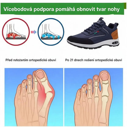 Ortopedická obuv speciálně navržená pro osoby s problémy chodidel, poskytující podporu klenby a pomáhající zmírnit bolesti zad, kloubů a chodidel.