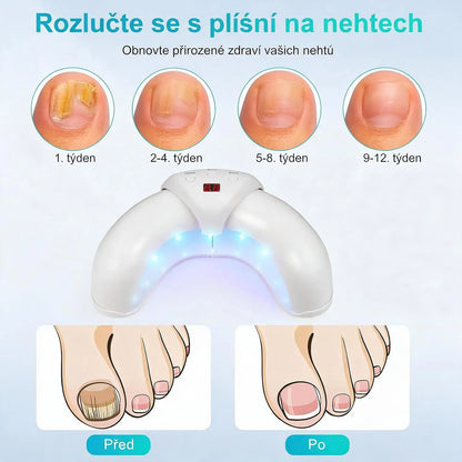 Trojitá Lampa pro Péči o Nehty – 7 Minut Denně pro Čistší a Zdravější Vzhled Nehtů