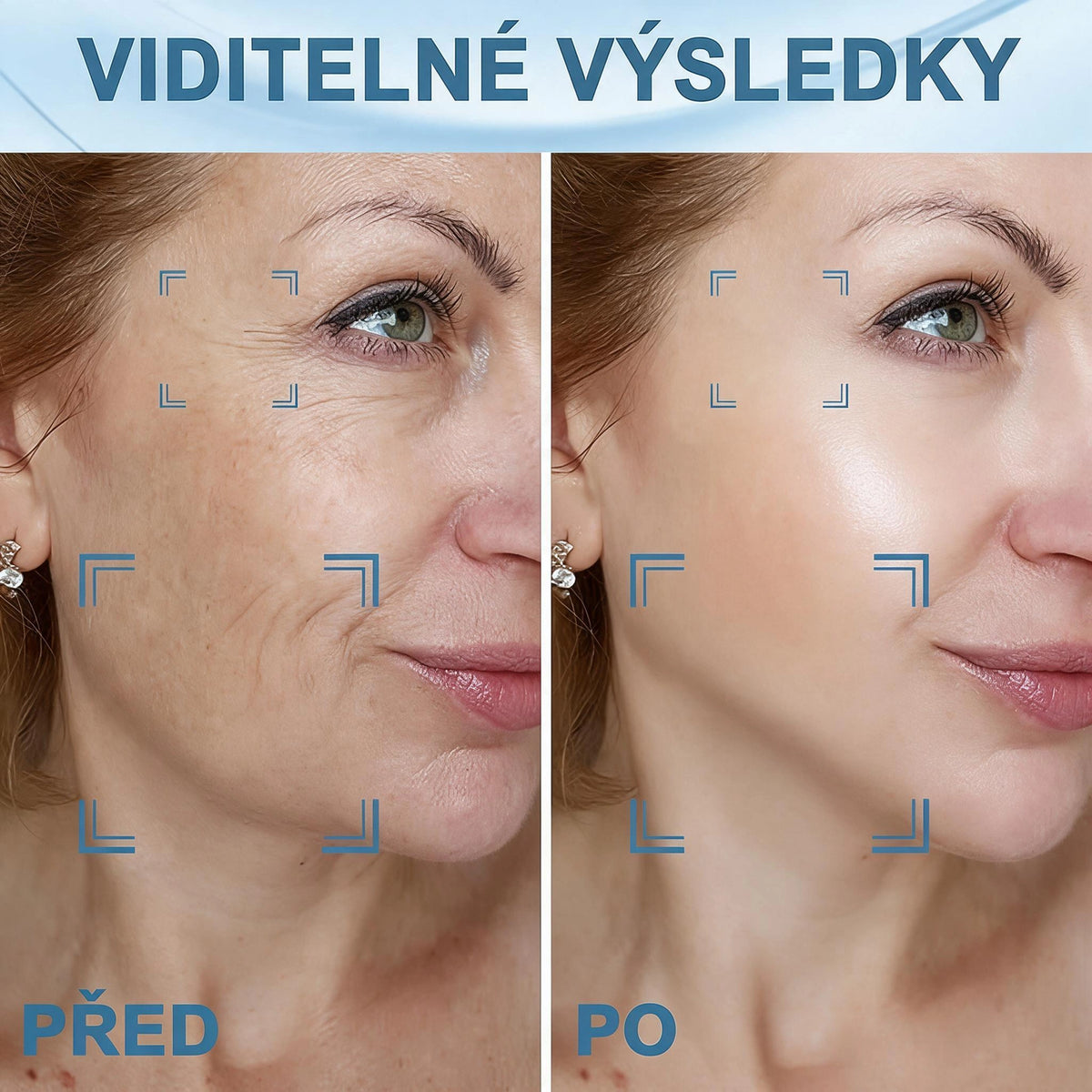 Přístroj s červeným světlem pro zpevnění a omlazení pleti obličeje, krku a paží – navržený speciálně pro zralou ženskou pleť, aby byly kontury hladší a pevnější.