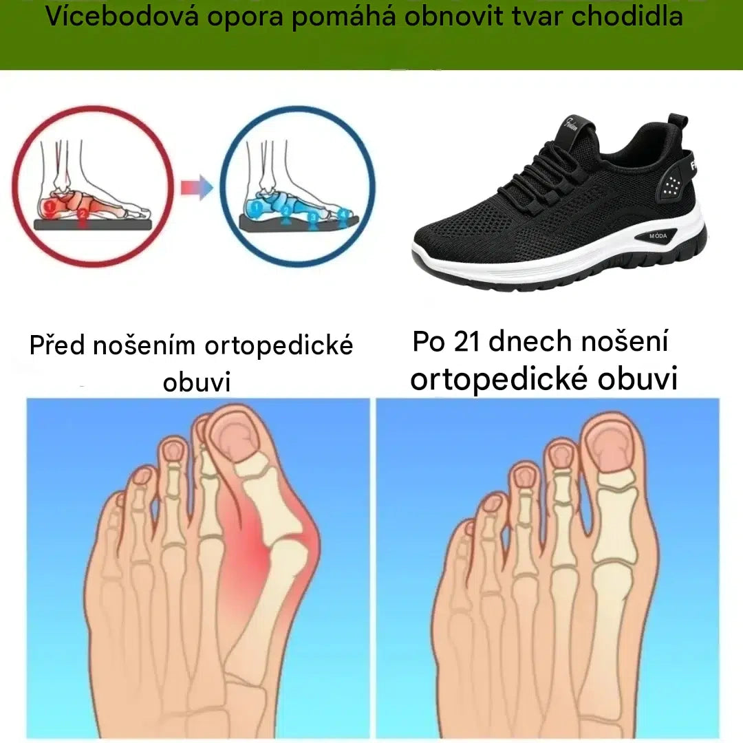 【⏰Poslední den, sleva 50%! Nenechte si ji ujít!】ortopedické dámské boty s měkkou odpruženou podrážkou – pohodlná chůze bez bolesti po celý den!